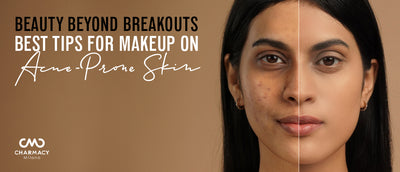Beauty Beyond Breakouts: Best Tips For Makeup On Acne-Prone Skin